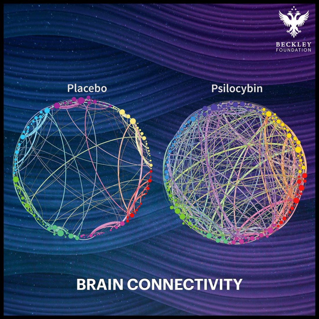 psilocybin brain connectivity